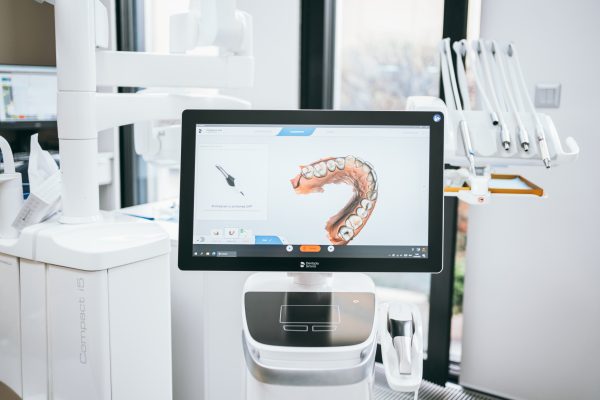 Snímek z intraorálního scanneru v Schill Dental Clinic